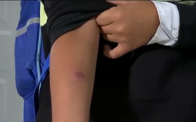 42 ребенка пострадали в Актобе из за врачебной халатности