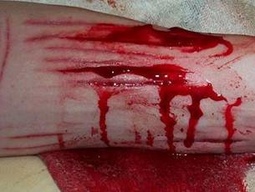 В Семее женщина пыталась совершить суицид