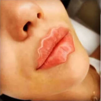Хочу «губы-осьминожки!»: Новый beauty-тренд в Казахстане