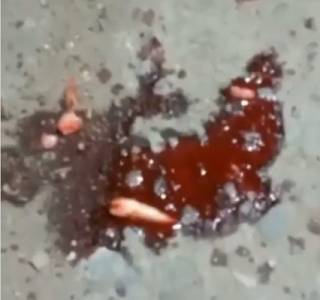 Выбитые зубы и гематомы: девушка на велосипеде угодила в яму в Семее