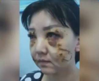 Мужчину, изуродовавшего бывшую жену, приговорили к четырем годам