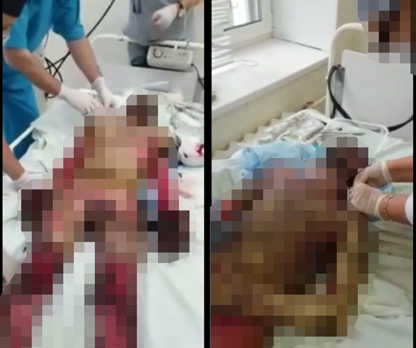 В Рудном сожгли заживо двух сборщиков металла
