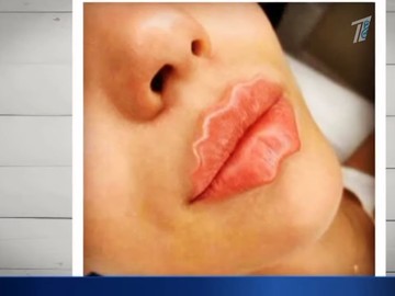 Хочу «губы-осьминожки!»: Новый beauty-тренд в Казахстане